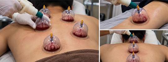 Upcoming Hijama Course Upcoming Hijama Course - HijamaLife Birmingham