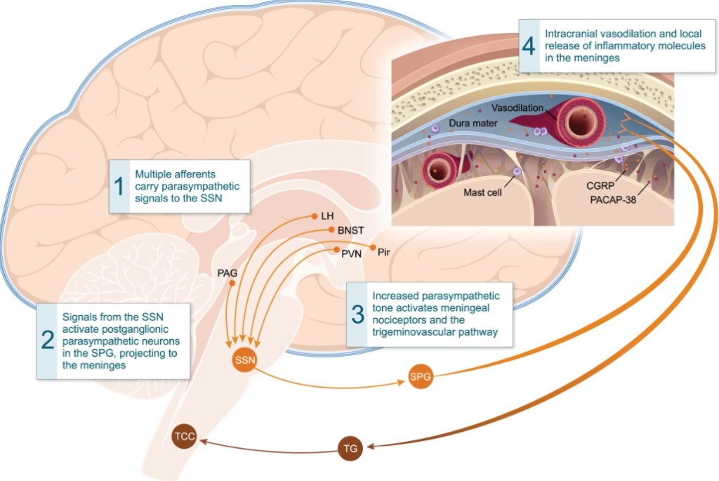 Migraine and Headache Pathophysiology - HijamaLife
